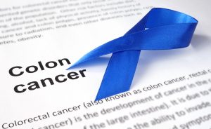 Picture of colon cancer ribbon for new screening guiddelines